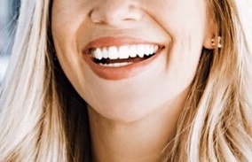 teeth whitening